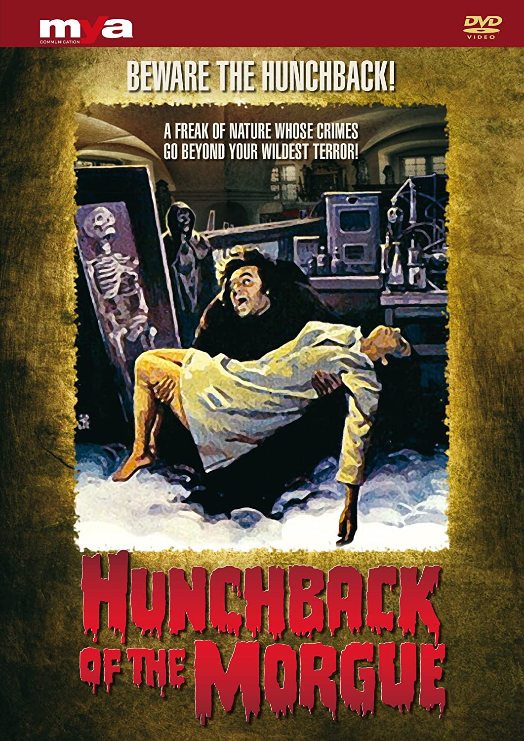 Hunchback Of The Morgue Dvd