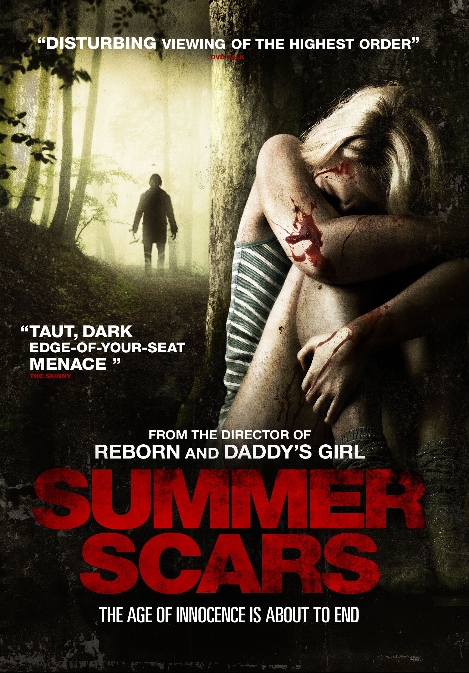 SUMMER SCARS DVD