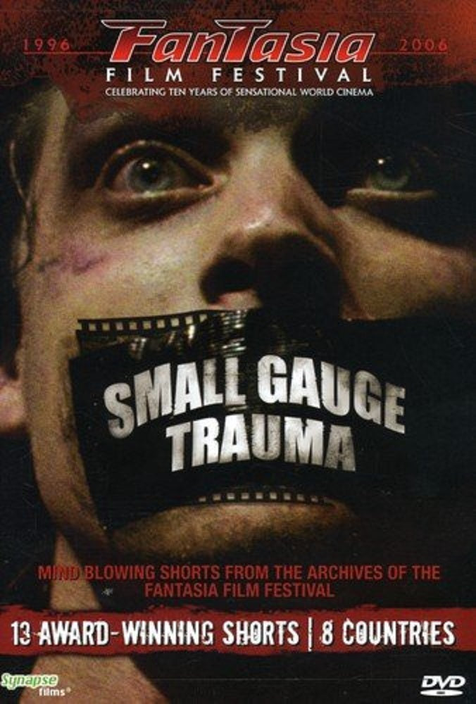 Small Gauge Trauma Dvd